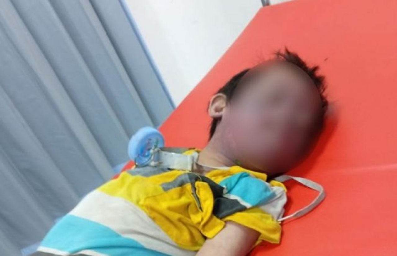 Kasus Anak Down Syndrome Meninggal di Surabaya, Terduga Pelaku Jalani Pemeriksaan Psikologis